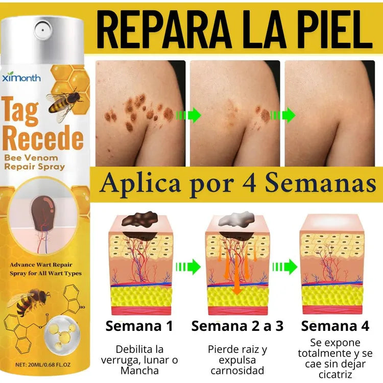 BEECLEAR™ TAG RECEDE ELIMINADOR DE VERRUGAS + ENVÍO GRATIS 🎁