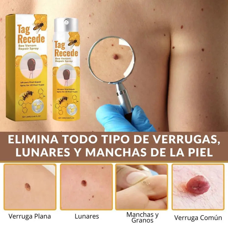 BEECLEAR™ TAG RECEDE ELIMINADOR DE VERRUGAS + ENVÍO GRATIS 🎁