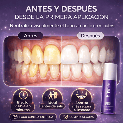 LumiSmile™ Blanqueador Dental Instantáneo + ENVÍO GRATIS 🎁
