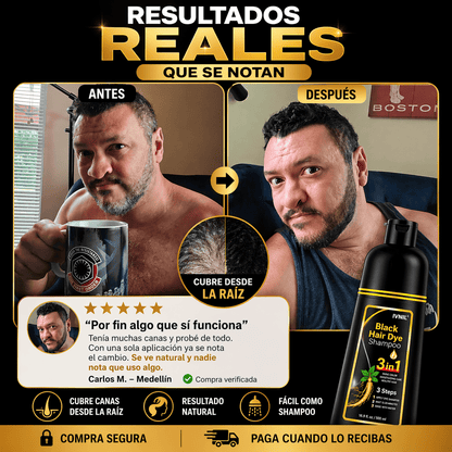 ¿CANSADO DE LAS CANAS QUE TE HACEN VER MAYOR?